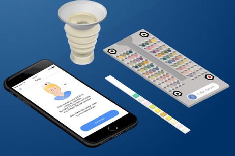 Análisis de orina digital: así es Healthy.io, startup israelí que revolucionará la salud Análisis de orina digital: así es Healthy.io, startup israelí que revolucionará la salud