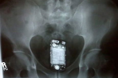 Los "mini-móviles" un dolor de cabeza en las cárceles de 20 euros, diminutos y fáciles de ocultar Los "mini-móviles" un dolor de cabeza en las cárceles de 20 euros, diminutos y fáciles de ocultar