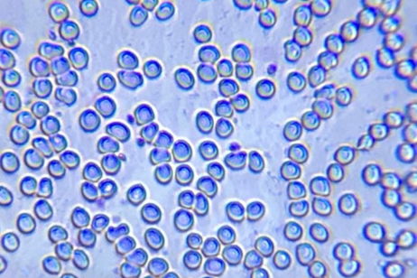 Este accesorio promete convertir la cámara de tu smartphone en un microscopio de verdad Este accesorio promete convertir la cámara de tu smartphone en un microscopio de verdad