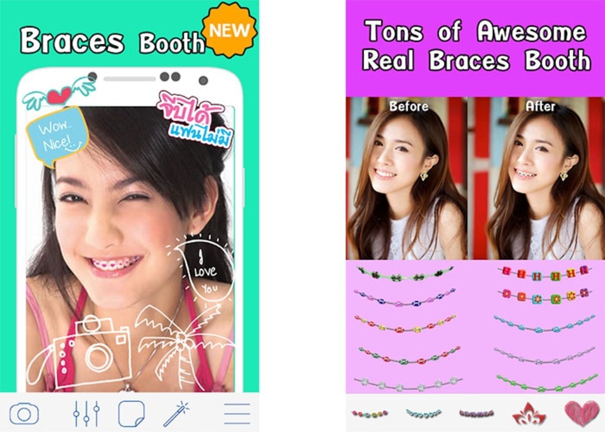 Braces Booth