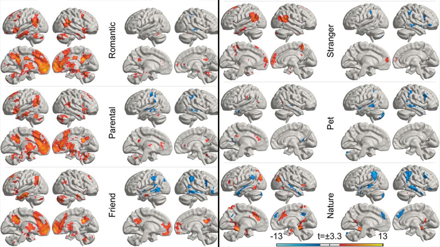 La ciencia sí puede explicar el amor: así se activa tu cerebro según seis tipos de amor que sientes