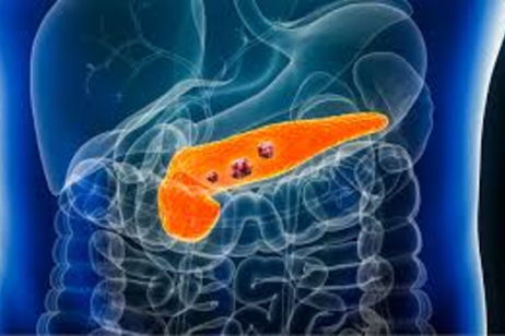 Han descubierto una nueva vacuna para el cáncer de páncreas: es prometedora