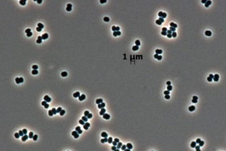 Así es la superbacteria que se infiltró en la NASA y que muy posiblemente hayamos enviado sin querer a Marte