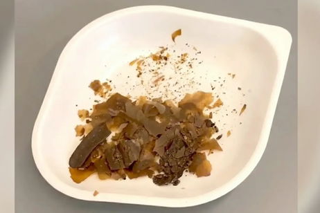 Los romanos usaban heces como medicina y ahora hay pruebas arqueológicas