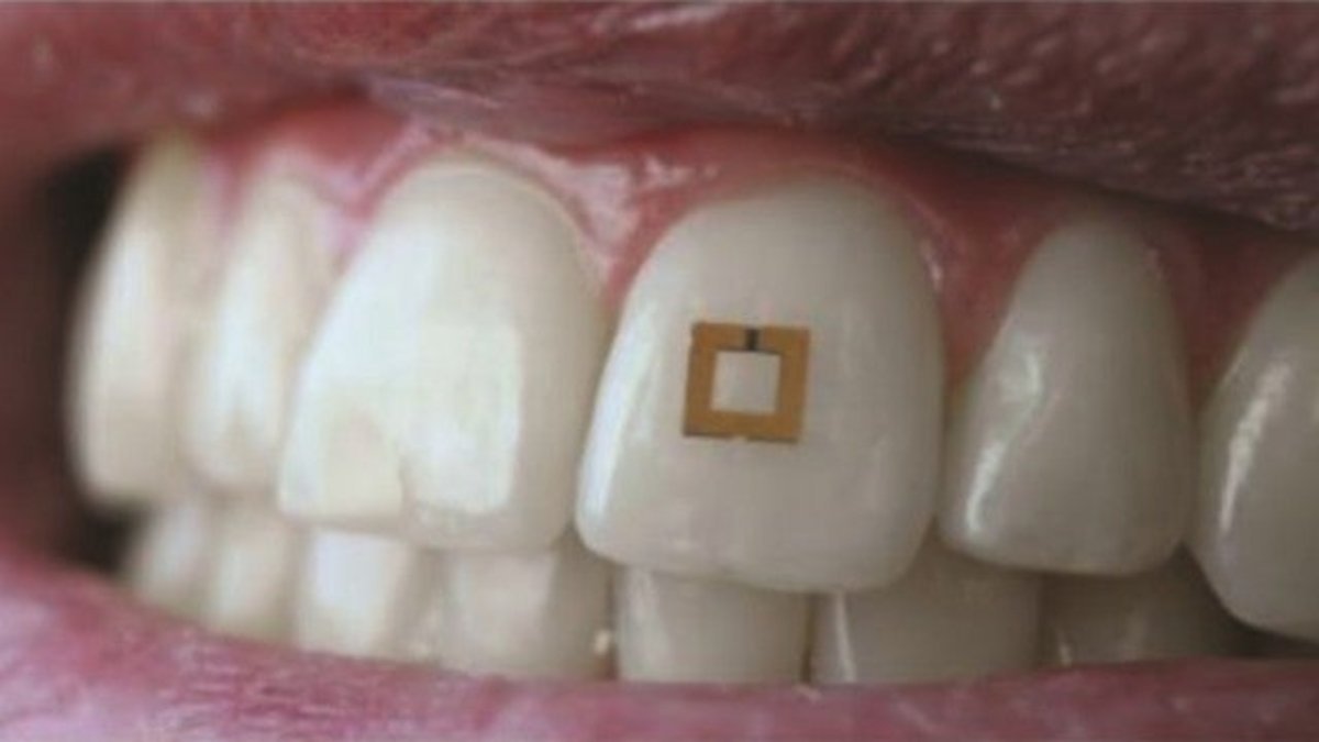Sensor wearable en los dientes